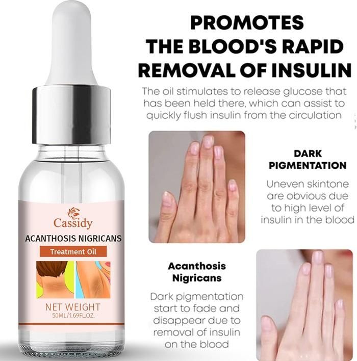 CASSIDY Acanthosis Nigricans Treatment Oil 40ml (Pack of 2)